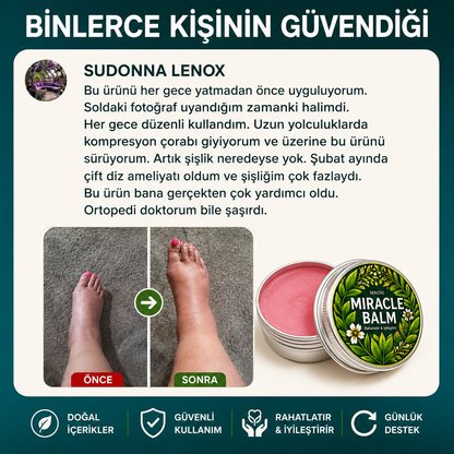 Senzio Miracle Balm™